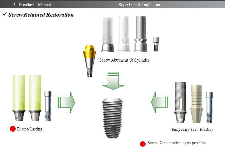 Implant Dentium chất lượng hoàn hảo giá cả cạnh tranh